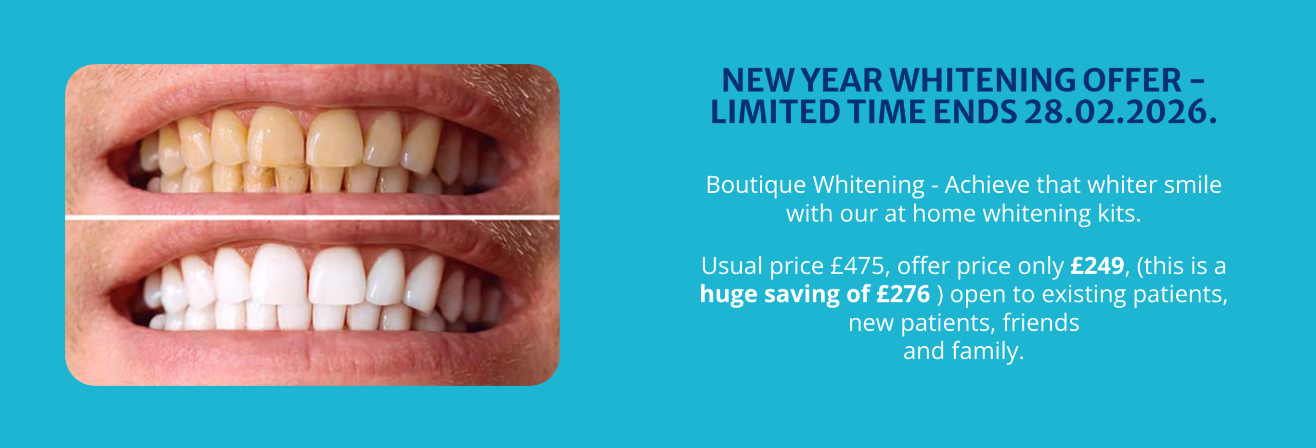 NEW YEAR WHITENING OFFER